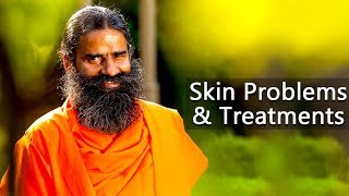 Skin Problems & Treatments | Swami Ramdev