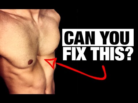 How to Fix a Sunken Chest! (PECTUS EXCAVATUM) How to Fix a Sunken Chest! (PECTUS EXCAVATUM)