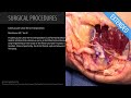 Submuscular Ulnar Nerve Transposition - Extended (Feat. Dr. Mackinnon)