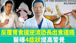 【健康療天室】反覆胃食道逆流恐長出食道癌　醫曝4症狀提高警覺  @ChinaTimes