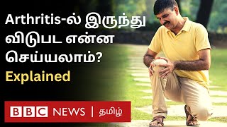 Arthritis யார் யாருக்கெல்லாம் வரும்? முன்கூட்டியே கண்டறிவது எப்படி? அறிகுறிகள் என்ன? தீர்வு என்ன?