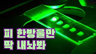 피 한 방울로 알츠하이머를 진단한다?  / YTN 사이언스