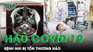 Hy Hữu Hậu Covid-19, Một Bệnh Nhi 13 Tuổi Bị Tổn Thương Não Nguy Hiểm | SKĐS