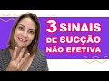 Amamentação 3 sinais que mostram que o bebê pode não estar fazendo sucção efetiva