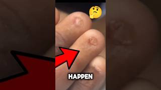 What If Fingernails Never Existed? 👀