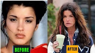 15 Celebrities Before and After Plastic Surgery