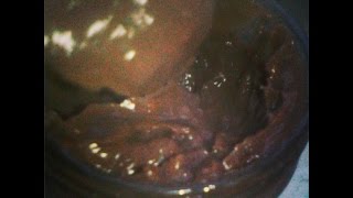 ნუტელა რეცეპტი/Nutella recipe