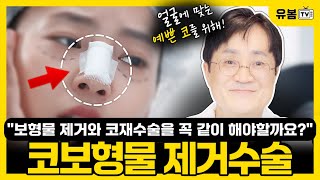 코보형물 제거수술, 꼭 알아야 할 모든 것! 코 성형 부작용 해결 방법 공개 | 코성형, 코수술, 코보형물, 보형물, 전후, 제거수술 | 유봄성형외과 이정수 대표원장