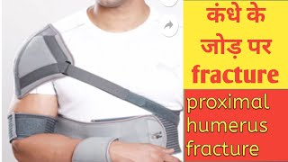 Shouldre Fracture in Hindi - Proximal Humerus Fracture (Broken Shoulder)in Hindi