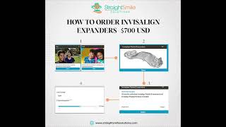 How to Order Invisalign First Expanders