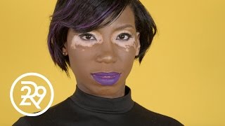 Model Gets Real About Her Vitiligo | Get Real | Refinery29