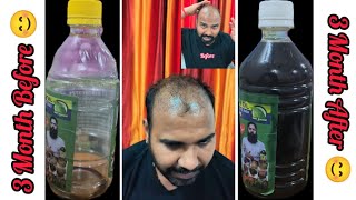 How To Use Adivasi Hair Oil/How To Apply Adivasi Oil/3 Month After Review part-3 #adivasi #oil #vlog