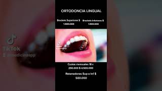 Tipos de ortodoncia ¿Cuál eliges? #brackets #ortodoncia #ortodoncista #asesoradeimagen #asesorias