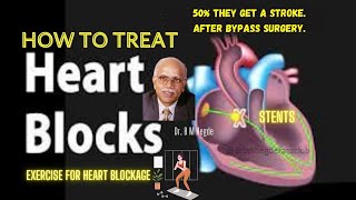 How to Treat Heart Blockages - Dr. B M Hegde
