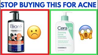 BEST ACNE FACE CLEANSER / COSDNA RESULTS!