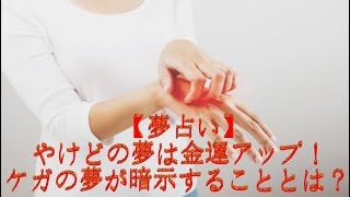 【夢占い】やけどの夢は金運アップ！　ケガの夢が暗示することとは？