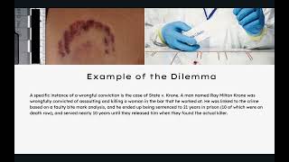 Bite Mark Analysis Presentation