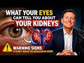Your Eyes Can Tell You About Your Kidneys | Warning Signs of Kidney Disease You Should Never Ignore