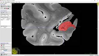 Overview of the hippocampus