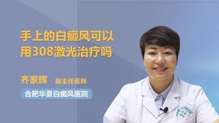 手上的白癜风可以用308激光治疗吗 齐家辉 合肥华夏白癜风医院