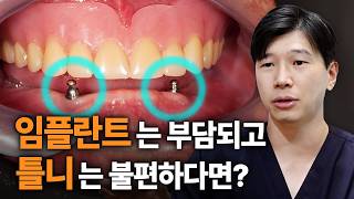 임플란트와 틀니의 장점을 합친 '임플란트 틀니'