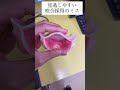 咬合採得のしやすいミス completedenture dentist 歯科技工士 dentaltreatment denture