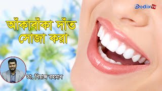 আঁকাবাঁকা দাঁতের সঠিক চিকিৎসা ‼ ডা. নিয়াজ রহমান