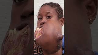 😔💔 Menina do Congo enfrenta um tumor gigante na sua mandíbula 🙌🏽💉 #MeuCorpoMeuDesafio