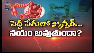 is Colon Cancer Curable? | Health Tip | Sukhibhava | 9th March 2022 | ETV AP