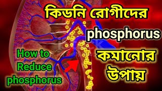 How to reduce phosphorus || কিডনি রোগীরা কীভাবে phosphorus কমাবেন || #phosphorous    #phosphate