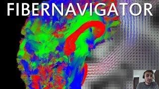 [DEMO] Real-time tractography and visualization tutorial using the FiberNavigator
