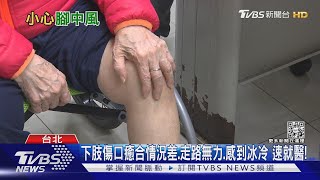 天冷保暖做好...注意身體狀況...若「這部位」缺血缺氧..恐面臨截肢!｜十點不一樣20221222@TVBSNEWS01