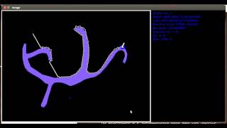 Bug 2 algorithm simulation : 2