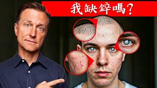 7個缺鋅警訊,自然療法,柏格醫生 Dr Berg