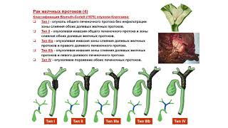 УЗИ . Доктор Иогансен. Выпуск 13. Злокачественные опухоли печени. Часть 1.