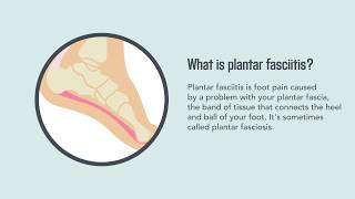 Plantar Fasciitis: Causes, Symptoms, and Treatment | Merck Manual Consumer Version
