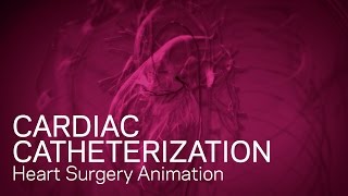 Cardiac Catheterization - Heart Animation
