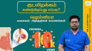 Hernia Types | Symptoms | Causes -குடலிறக்கம் கண்டுபிடிப்பது எப்படி? வகைகள் | அறிகுறிகள் | காரணிகள்