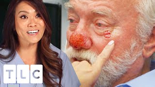"The Cancer Is Gone": Dr Lee's Limousine Driver's Second Operation | Dr. Pimple Popper