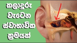 කන් කලාදුරු ස්වාභාවිකව ඉවත් කරගන්න,  Home Remedies To Remove Ear Wax Sinhala