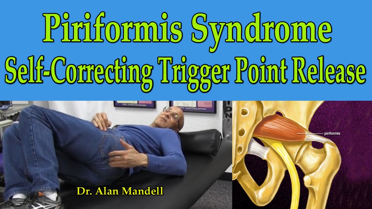 Piriformis Syndrome (Self-Correcting Trigger Point Release) - Dr ...