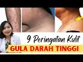 9 TABIAT YANG TIDAK DIKENALI PUNCA GULA DALAM DARAH TINGGI | KENCING MANIS | dr. Emasuperr