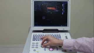 Mindray Ultrasound Z6 Colour Doppler Video