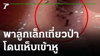 แม่ผวา พาลูกเล็กเที่ยวป่า โดนเห็บเข้าหู | 03-01-65 | ข่าวเย็นไทยรัฐ