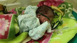 cute newborn baby after delivery, very cute baby videos