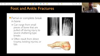 Podiatrist Shares Advice \u0026 Treatment Options on Common Foot \u0026 Ankle Problems