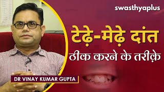 क्या ठीक हो सकते हैं टेढ़े मेढ़े दांत? | Dr Vinay Kumar Gupta on Crooked Teeth in Hindi