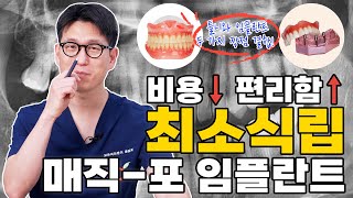 틀니? 임플란트? 아직도 고민된다면 매직포 임플란트! 단 4개의 식립으로 치아 전체 기능 회복하는 최소식립 임플란트 👍