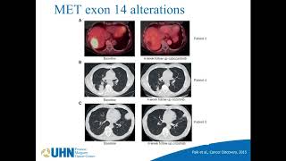 Novel Therapies for Thoracic Malignancies – Dr. Adrian Sacher