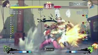 Nemo [Yang] vs robin01 [Abel] SSF4 Arcade Edition - Xbox Live Ranked Match